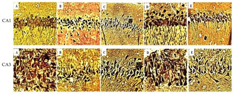 Andrographis Paniculata Protects Against Brain Hippocampus And