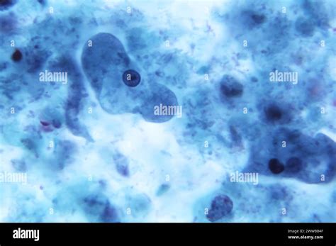 Parásito Ameba Entamoeba Coli Fotografías E Imágenes De Alta Resolución Alamy