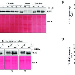 Pancreas inflammation induces protein expression of enzymes involved in... | Download Scientific ...