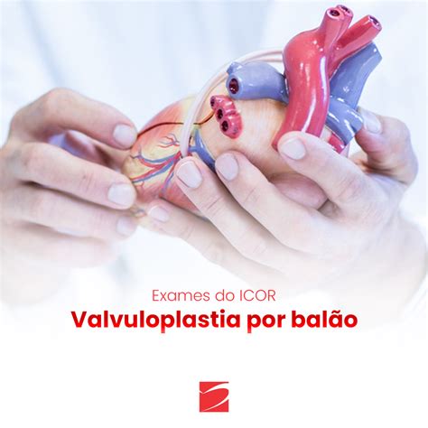 Valvuloplastia por balão ICOR Instituto do Coração de Santa Maria