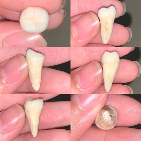 Jual Gigi Molar 1 2 Rahang Bawah Shopee Indonesia