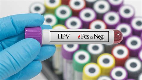 Positif Hpv Apakah Pasti Positif Kanker Serviks Juga Klikdokter