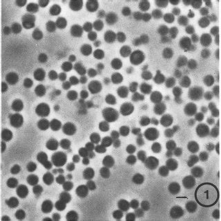 Transmission electron micrograph of isolated cortical granules, The CG ...