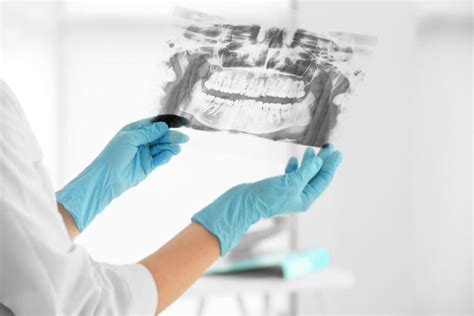 Different Types Of Dental X Rays Explained