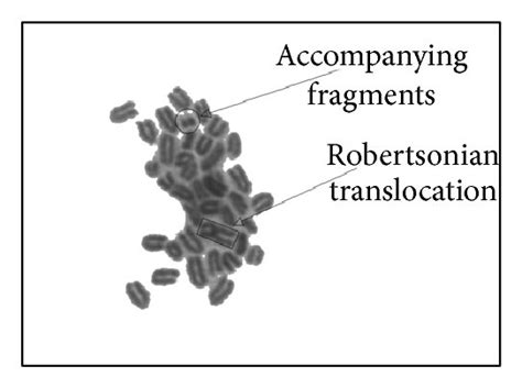 Photomicrographs Of Metaphase Bone Marrow Cells Week After