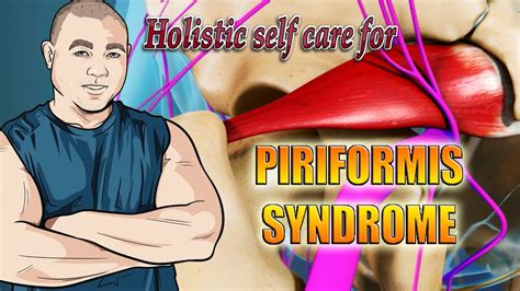 Holistic Self Care For Piriformis Syndrome Youtube