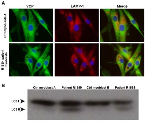 lamp antibody pa