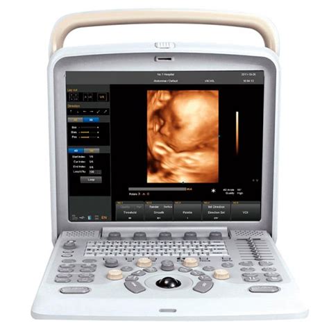 ULTRASONIDO CHISON Q5 UltrasoundWorld