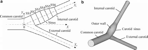 Level Of Carotid Bifurcation