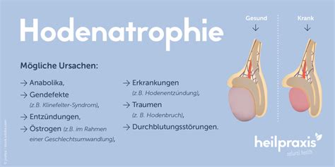 Hodenatrophie Ursachen Symptome Und Behandlung Heilpraxis