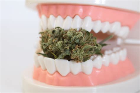 Is cannabis ruining your teeth? | Institute of Dental Implants ...