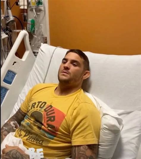 Dustin Poirier S Foot Almost Doubles In Size As Ufc Star Battles Serious Infection Irish