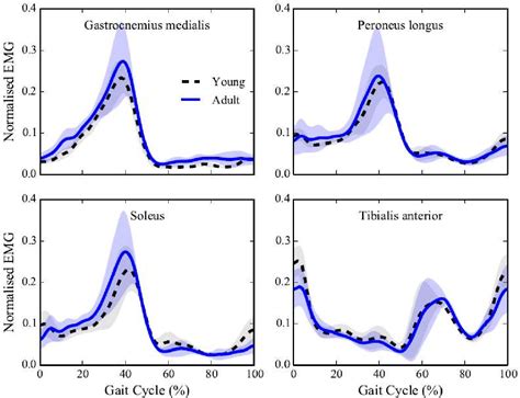 Figure 3 From Statistical Parametric Mapping SPM For Alpha Based