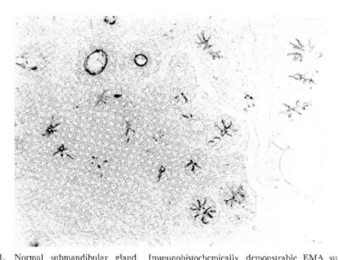 Figure From Immunohistochemical Expression Of Monoclonal Antibody