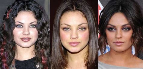 Mila Kunis Plastic Surgery Before and After Pictures 2018