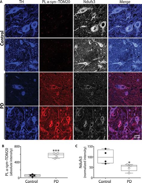 Synuclein Binds To Tom And Inhibits Mitochondrial Protein Import In