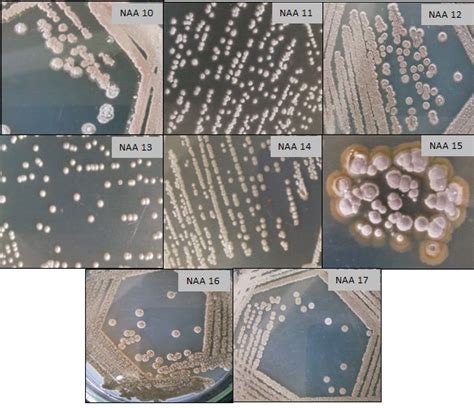 Colony Morphology Of Different Actinomycete Isolates On SCA Medium