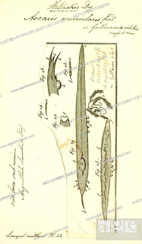 Ascaris Vesicularis Print Image Showing Life Cycle Inside And Outside Of The Human Body Of One