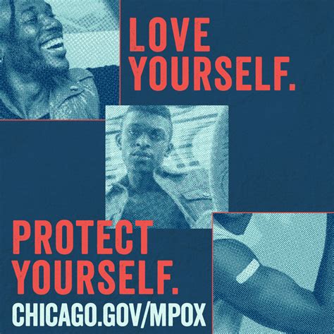 City Of Chicago Mpox Resources