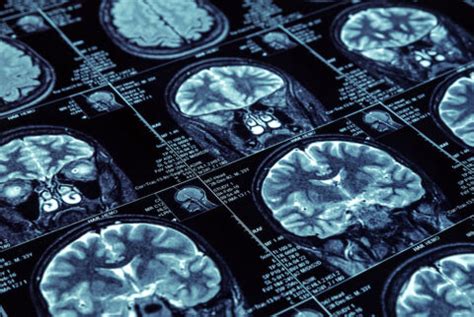 Female Sex Hormones Brain Function And Mental Health How Sex Hormones Shape Our Brain