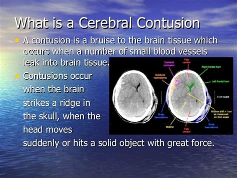 Head Injury