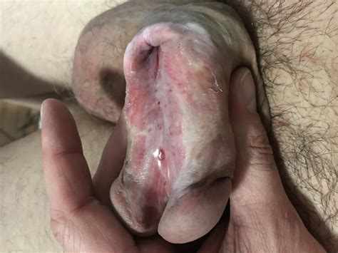 Fake Boobs Feel Fantastic Nude Pics XHamster