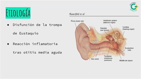 Sesión Clínica Otitis Media Serosa 2 Pediatra De Atención Primaria