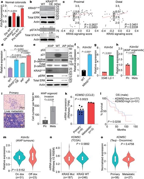 Histone Demethylase KDM5D Upregulation Drives Sex Differences In Colon