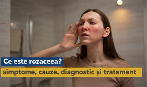 Ce Este Rozaceea Simptome Cauze Diagnostic I Tratament Centrul