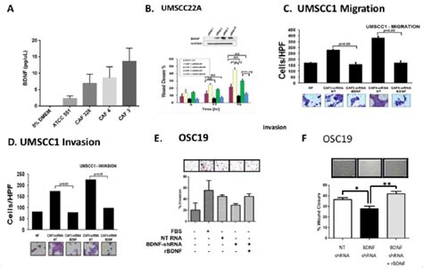 CAFs Promote Tumor Cell Migration Invasion And Progression By