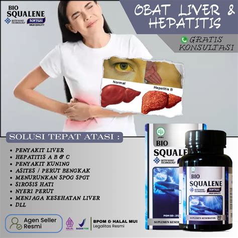 Jual Obat Jamu Fatty Liver Hepatitis A B C Pembengkakan Limpa Dan Nyeri