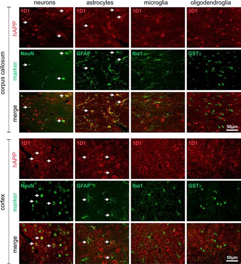 Cell Type Specific Expression Of Happ In Brains Of Month Old Tg