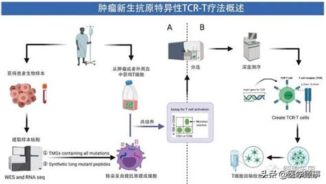 实体肿瘤治疗大杀器与CAR T并驾齐驱的TCR T