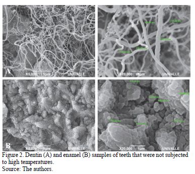 vitro behavior   dentin  enamel calcium hydroxyapatite