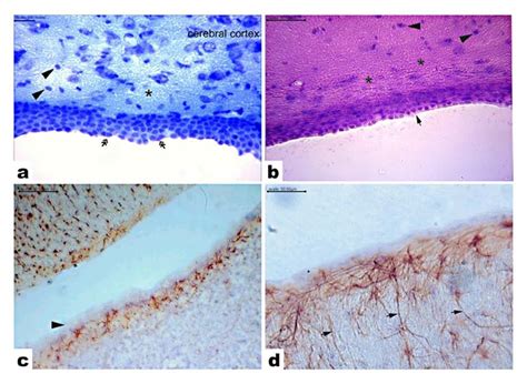 Ependymal Cells Histology