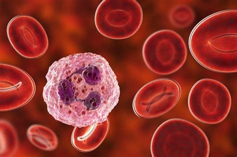 Ryzneuta Approved For Patients With Non Myeloid Malignancies Cancer