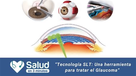 Glaucoma La Silenciosa Enfermedad Ocular Que Deteriora La Visión Para