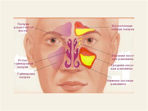 Клиновидная Пазуха Носа Фото — Nyafoto.ru