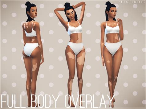 The Sims Resource - Vitiligo Beauty Skin Overlay N2