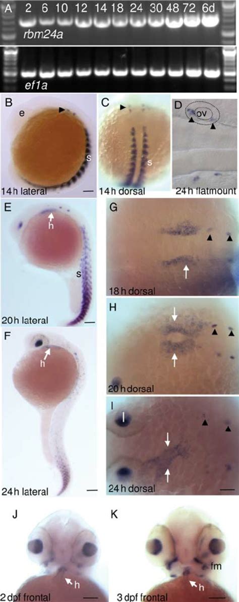 Rbm A Expression In The Zebrafish Embryonic Heart Precursors Precedes