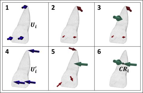 Numeric Simulation Model For Long Term Orthodontic Tooth Movement With Contact Boundary