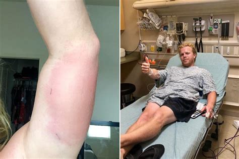 Florida Man Gets Flesh Eating Bacteria After Lake Trip