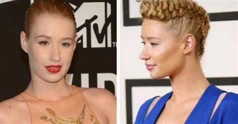 Iggy Azalea Admits Getting Boob Job Months Ago See Before After Pics This Is
