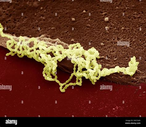 Streptococcus Pneumoniae Farbig Scanning Electron Micrograph Sem S