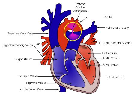 Ligamentum Arteriosum Location, Function & Clinical Significance ...