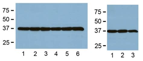 Gapdh Mouse Monoclonal Antibody Ga R Medimabs