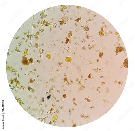 Parasites In Stool Microscope