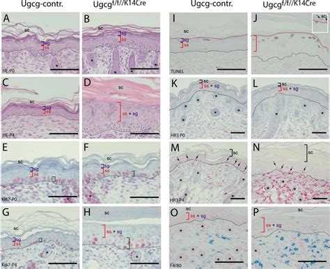 Skin Morphology And Immunohistochemistry Of Ugcg Flox Flox K Cre Mice