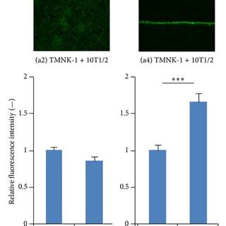 Expression Of Tmnk Phenotypic Marker Vap A And Lyve B In