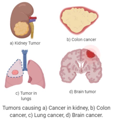 Carcinogen Examples